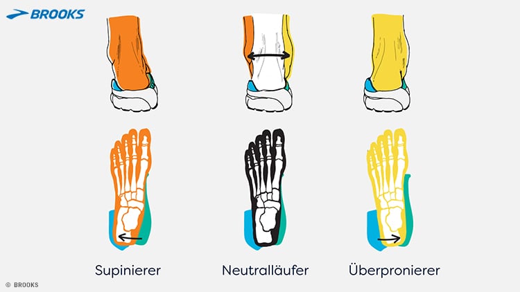 Grafik mit drei Arten der Fußpronation: Supinierer (Fuß kippt nach außen), Neutralläufer (neutrale Fußstellung) und Überpronierer (Fuß kippt nach innen). Oben jeweils die Rückansicht von Schuh und Knöchel, unten die Skelettansicht des Fußes von oben. Oben links ist das Markenlogo Brooks zu sehen